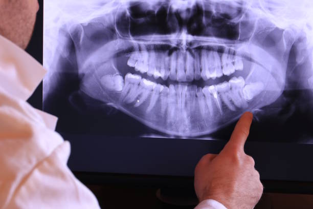 Best Chipped Tooth Repair Near Me  in Calhoun Falls, SC